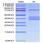 Human MSPR/Ron Protein (RON-HM101)