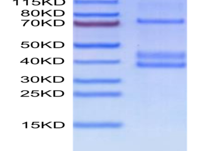 Human MSPR/Ron Protein (RON-HM101)