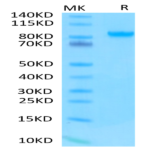 Human/Cynomolgus/Rhesus macaque ROR1 Protein (ROR-HM201)