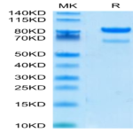 Human ROR2/NTRKR2 Protein (ROR-HM202)