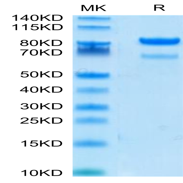 Human ROR2/NTRKR2 Protein (ROR-HM202)