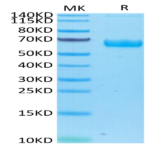 Human/Cynomolgus/Rhesus macaque ROR1 Protein (ROR-HM401)