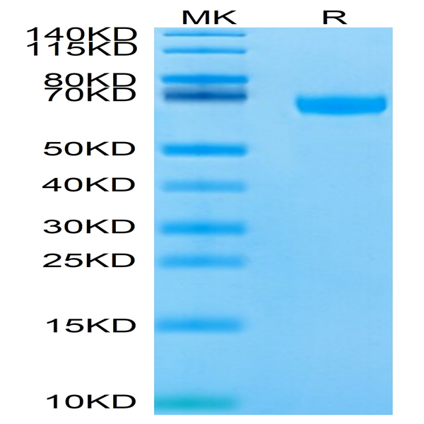 Biotinylated Human/Cynomolgus/Rhesus macaque ROR1 Protein (ROR-HM401B)