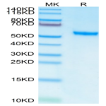 Human ROR2/NTRKR2 Protein (ROR-HM402)