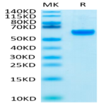 Biotinylated Human ROR2/NTRKR2 Protein (ROR-HM402B)