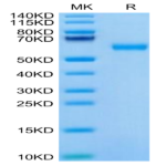 Mouse ROR1 Protein (ROR-MM101)