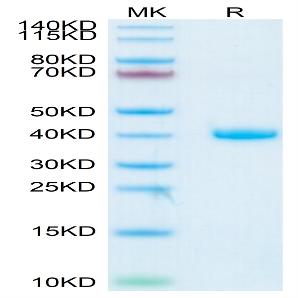 Human R spondin 1/RSPO1 Protein (RS1-HM101)