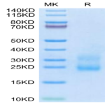 Human R spondin 3/RSPO3 Protein (RSP-HM103)