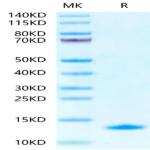 Human S100A14 Protein (SA4-HE114)