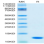 Human S100A8 Protein (SA8-HE101)
