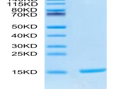 Cynomolgus S100A9/MRP14 Protein (SA9-CE101)