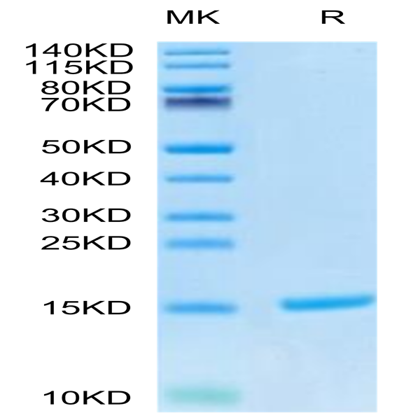 Cynomolgus S100A9/MRP14 Protein (SA9-CE101)