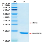 Human S100A9/MRP14 Protein (SA9-HE101)
