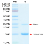 Mouse S100A9/MRP14 Protein (SA9-ME101)