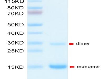 Mouse S100A9/MRP14 Protein (SA9-ME101)