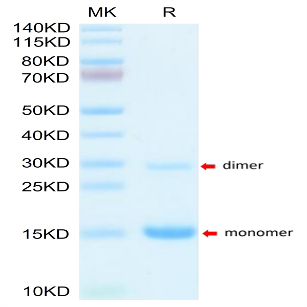 Mouse S100A9/MRP14 Protein (SA9-ME101) Mouse S100A9/MRP14 Protein (SA9-ME101)