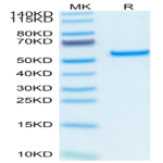 Human Pentraxin 2/SAP Protein (SAP-HM201)