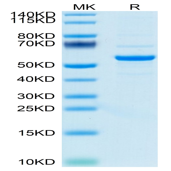Mouse Pentraxin 2/SAP Protein (SAP-MM201)