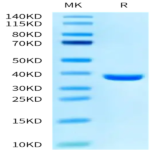 SARS PLpro/papain-like protease Protein (SAR-VE101)