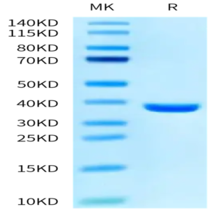 SARS PLpro/papain-like protease Protein (SAR-VE101)