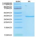 SARS PLpro/papain-like protease Protein (SAR-VE1PL)