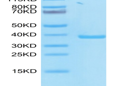 SARS PLpro/papain-like protease Protein (SAR-VE1PL)