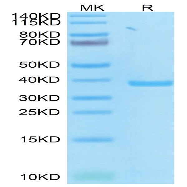 SARS PLpro/papain-like protease Protein (SAR-VE1PL)