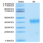 SARS Spike RBD Protein (SAR-VM4BD)