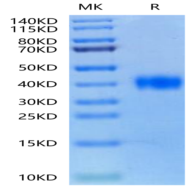 Biotinylated SARS Spike RBD Protein (SAR-VM4BDB)