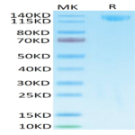 SARS Spike S1 Protein (SAR-VM5S1)