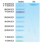 Biotinylated SARS Spike S1 Protein (SAR-VM5S1B)