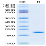 Human SCF Protein (SCF-HE001)