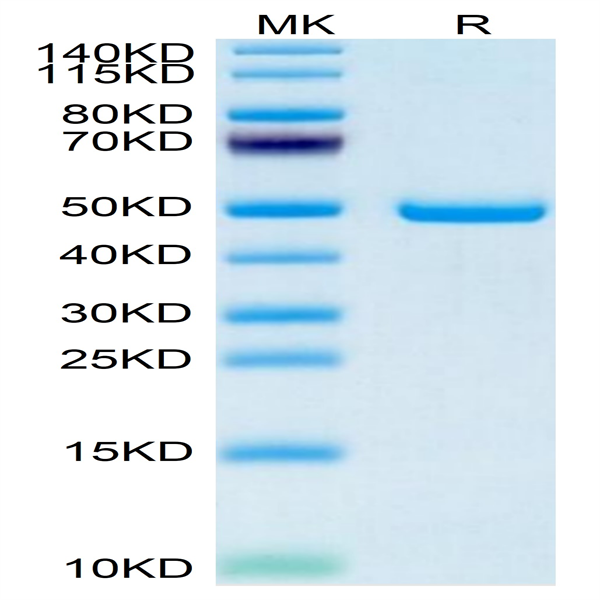 Human SECTM1 Protein (SEC-HM201)