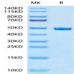 Human SETD7 Protein (SED-HM107)