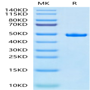 Human SETD7 Protein (SED-HM107)