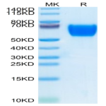 Human SELL/CD62L Protein (SEL-HM10L)