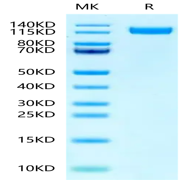 Human P-Selectin/CD62P Protein (SEL-HM10P)