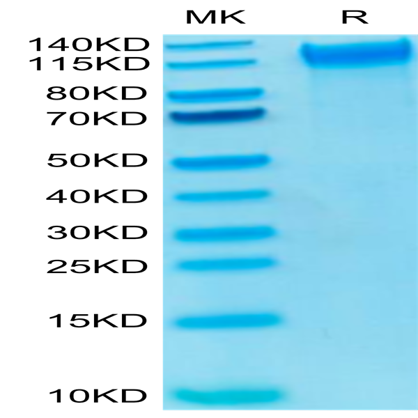 Biotinylated Human P-Selectin/CD62P Protein (SEL-HM40PB)