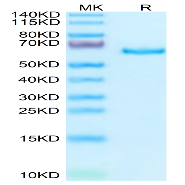 Human SEMA3A Protein (SEM-HM13A)