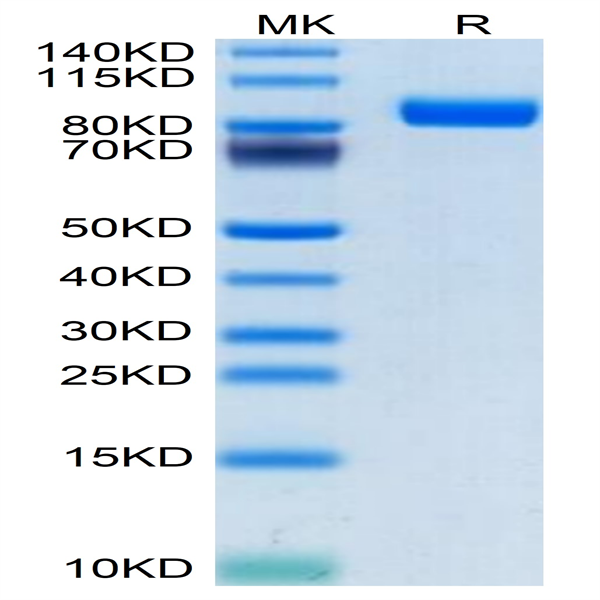 Human SEMA4B Protein (SEM-HM14B)
