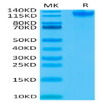 Human Semaphorin 4D/SEMA4D/CD100 Protein (SEM-HM44D)