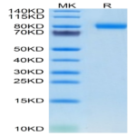 Mouse SEMA4B Protein (SEM-MM14B)