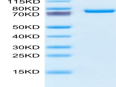 Mouse SEMA7A Protein (SEM-MM17A)