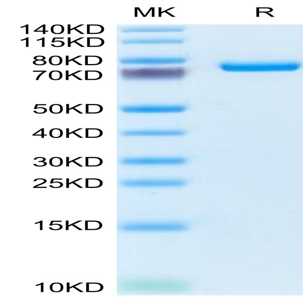 Mouse SEMA7A Protein (SEM-MM17A)