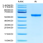 Rat Serpina3n Protein (SEP-RM101)