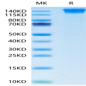 Human SEZ6 Protein (SEZ-HM106)