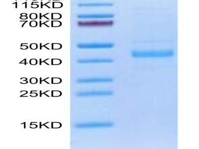 Human SFRP1/SARP2 Protein (SFP-HM101)