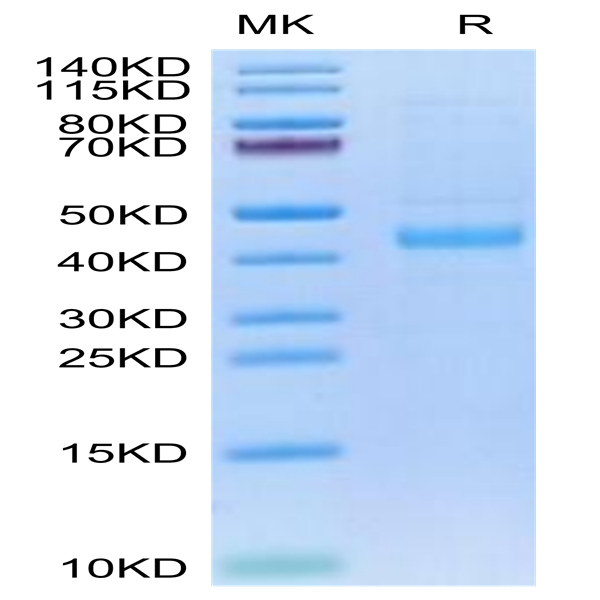 Human SFRP1/SARP2 Protein (SFP-HM101) Human SFRP1/SARP2 Protein (SFP-HM101)