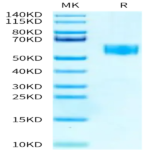 Human SIGIRR Protein (SGR-HM201)