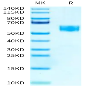 Human SIGIRR Protein (SGR-HM201)